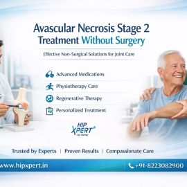 Avascular Necrosis Stage 2 Treatment Without Surgery – HipXpert