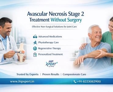 Avascular Necrosis Stage 2 Treatment Without Surgery – HipXpert